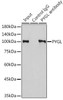 Metabolism Antibodies 2 Anti-PYGL Antibody CAB6710