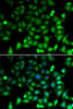 Cell Cycle Antibodies 1 Anti-RAE1 Antibody CAB6713