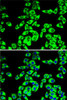Cell Biology Antibodies 10 Anti-RPL14 Antibody CAB6724