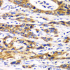 Cell Biology Antibodies 10 Anti-RPN1 Antibody CAB6726