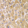 Cell Biology Antibodies 10 Anti-RPN1 Antibody CAB6726