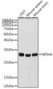Cell Biology Antibodies 10 Anti-RPS4X Antibody CAB6730