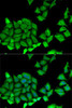 Cell Biology Antibodies 10 Anti-RPS7 Antibody CAB6731