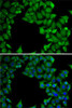 Cell Death Antibodies 2 Anti-RTKN Antibody CAB6732