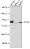 Cell Death Antibodies 2 Anti-RTKN Antibody CAB6732