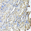 Cell Biology Antibodies 10 Anti-SCYL1 Antibody CAB6735