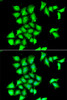 Immunology Antibodies 2 Anti-MSRB1 Antibody CAB6737