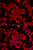 Immunology Antibodies 2 Anti-SLC20A2 Antibody CAB6739