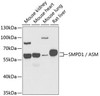 Cell Biology Antibodies 10 Anti-SMPD1 / ASM Antibody CAB6743