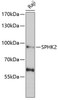 Cell Biology Antibodies 10 Anti-SPHK2 Antibody CAB6748