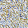 Metabolism Antibodies 2 Anti-SPTLC1 Antibody CAB6750