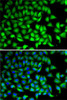 Cell Biology Antibodies 10 Anti-SUFU Antibody CAB6757
