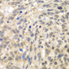 KO Validated Antibodies 1 Anti-TLK2 Antibody CAB6770KO Validated