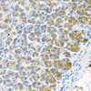 Cell Biology Antibodies 10 Anti-WFDC2 Antibody CAB6788