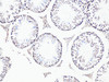 Cell Biology Antibodies 16 Anti-Bcl9 Antibody CAB6795