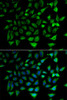 Signal Transduction Antibodies 3 Anti-SLC25A20 Antibody CAB6880