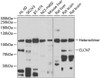 Signal Transduction Antibodies 3 Anti-CLCN7 Antibody CAB6886