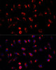 Cell Biology Antibodies 10 Anti-GALNT2 Antibody CAB6910
