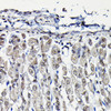Cell Biology Antibodies 10 Anti-PFKFB3 Antibody CAB6945