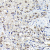 Cell Biology Antibodies 10 Anti-PFKFB3 Antibody CAB6945