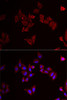 Cell Biology Antibodies 10 Anti-MAP2K5 Antibody CAB6953