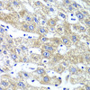 Metabolism Antibodies 2 Anti-QARS Antibody CAB6960