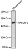 Cell Biology Antibodies 10 Anti-RASGRF1 Antibody CAB6964