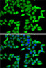 Epigenetics and Nuclear Signaling Antibodies 4 Anti-RBBP5 Antibody CAB6965