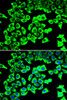 Cell Biology Antibodies 10 Anti-RPLP2 Antibody CAB6974
