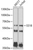 Epigenetics and Nuclear Signaling Antibodies 4 Anti-SS18 Antibody CAB6990