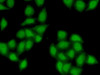 Epigenetics and Nuclear Signaling Antibodies 4 Anti-SS18 Antibody CAB6990