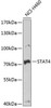 Epigenetics and Nuclear Signaling Antibodies 4 Anti-STAT4 Antibody CAB6991