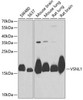Cell Biology Antibodies 10 Anti-VSNL1 Antibody CAB6999