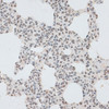 Epigenetics and Nuclear Signaling Antibodies 4 Anti-ZNF148 Antibody CAB7001