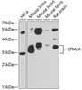 Autophagy Antibodies Anti-EPM2A Antibody CAB7007