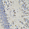 Metabolism Antibodies 2 Anti-EIF3C Antibody CAB7022