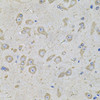 Metabolism Antibodies 2 Anti-EIF3F Antibody CAB7023