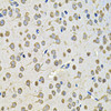 Metabolism Antibodies 2 Anti-EIF3F Antibody CAB7023