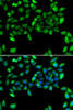 Metabolism Antibodies 2 Anti-EIF3H Antibody CAB7024