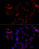 Cell Biology Antibodies 10 Anti-COPB2 Antibody CAB7036