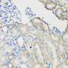 Cell Biology Antibodies 10 Anti-TGM5 Antibody CAB7039