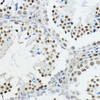 Cell Biology Antibodies 10 Anti-NCOR1 Antibody CAB7046