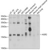 Cell Biology Antibodies 10 Anti-AGR2 Antibody CAB7064