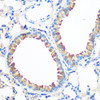 Cell Biology Antibodies 10 Anti-AGR2 Antibody CAB7064
