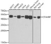 Signal Transduction Antibodies 3 Anti-STAMBP Antibody CAB7065