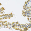 ChIP Antibodies Anti-NMU Antibody CAB7068