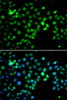 Cell Biology Antibodies 10 Anti-MTF2 Antibody CAB7077