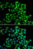Cell Cycle Antibodies 2 Anti-CLASP1 Antibody CAB7081