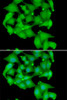 Cell Biology Antibodies 10 Anti-PRKD3 Antibody CAB7084