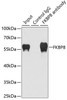 Cell Death Antibodies 2 Anti-FKBP8 Antibody CAB7085